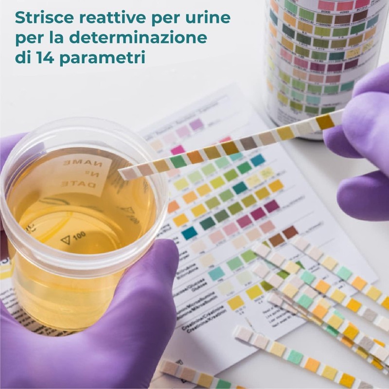 App Life Test Urine 14 Parametri - Confezione da 100 pz di Strisce Reattive per Analisi Urinalisi - Bastoncini di alta qualità
